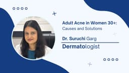 Adult Acne in Women 30+: Causes and Solutions Adult Acne in Women 30+: Causes and Solutions