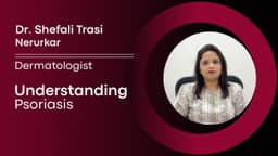 Understanding Psoriasis Understanding Psoriasis