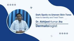 Dark Spots vs Uneven Skin Tone: How to Identify and Treat Them Dark Spots vs Uneven Skin Tone: How to Identify and Treat Them