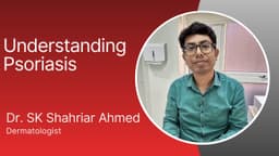 Understanding Psoriasis Understanding Psoriasis